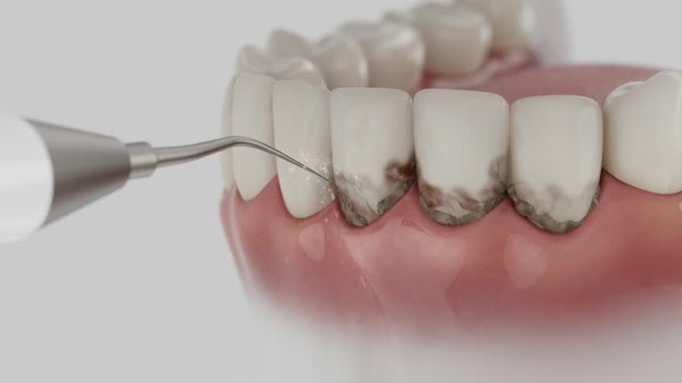 Trusted Teeth Cleaning And Checkup service in Ferndale, MD - Dentist Open Now